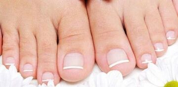 Prevenzione dell'aspetto del fungo sulle unghie delle gambe