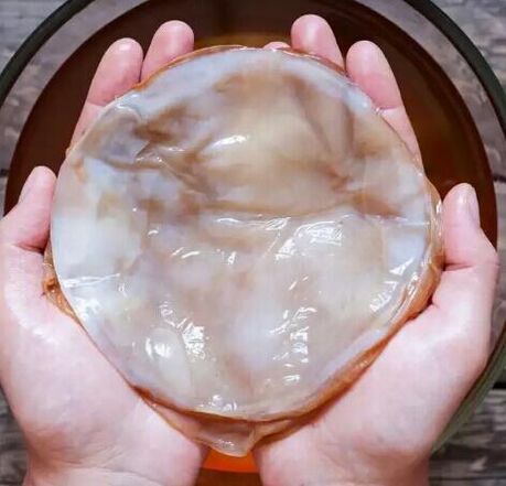 Kombucha, fungo delle unghie